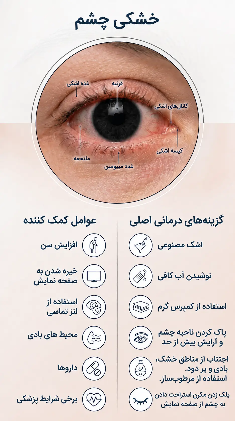 علت خشکی چشم