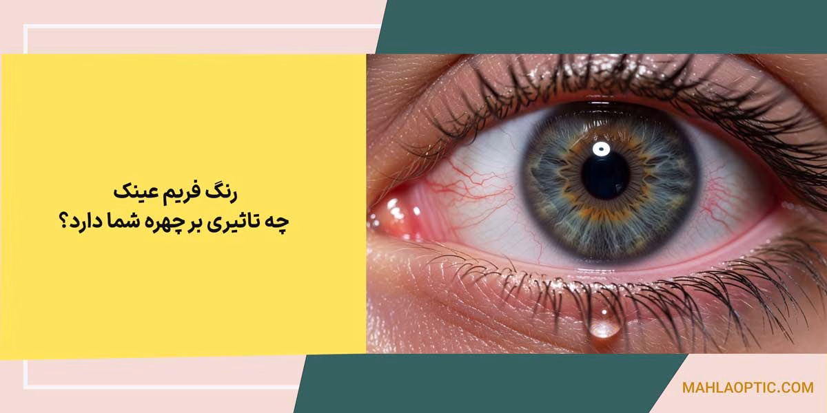 عفونت چشم ناشی از لنز: علائم هشدار دهنده را جدی بگیرید