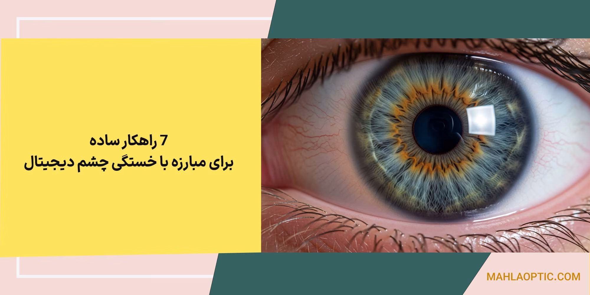7 راهکار ساده برای مبارزه با خستگی چشم دیجیتال (مخصوص کارمندان و دانشجویان)