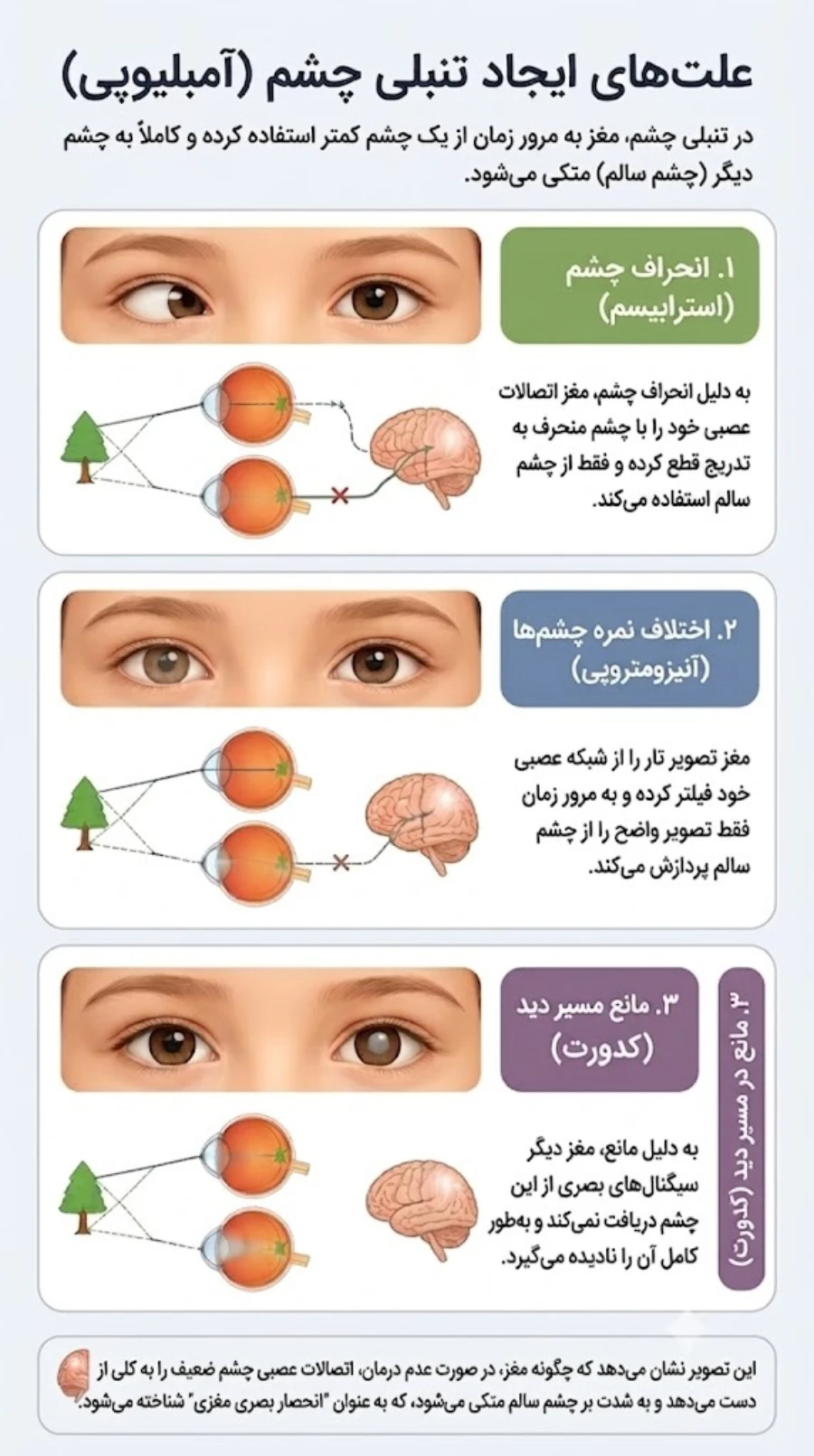 علت های تنبلی چشم